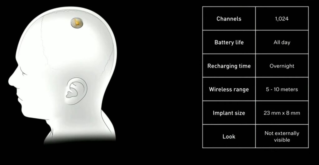 Neuralink Çip'in Özellikleri