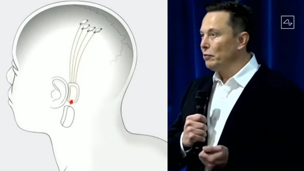 Neuralink projesi nedir