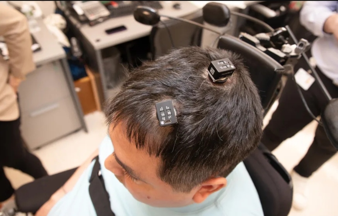 Yapay zeka özellikli beyin implantı, hastanın duygu ve hareketini yeniden kazanmasına yardımcı olacak